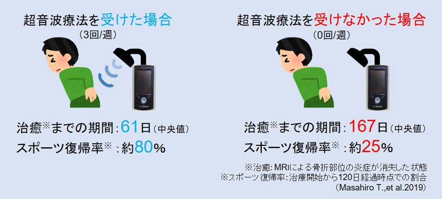 超音波治療ってなに?