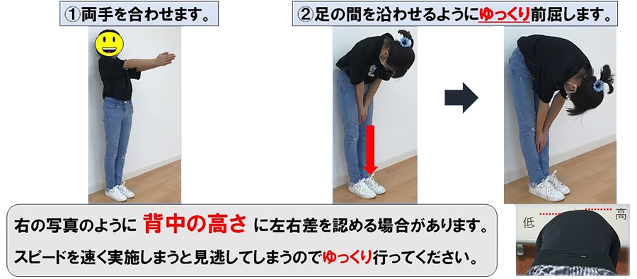 前屈テスト(Adam’s forward bending test)を行ってみましょう!