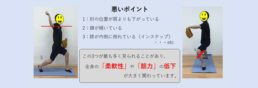 肩や肘に負担のかかる投球フォーム