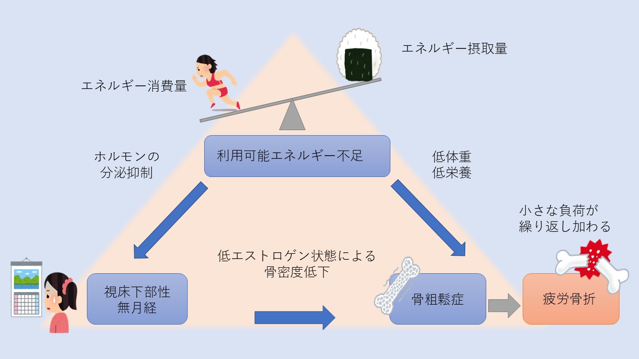 女性アスリートの三主徴とは？