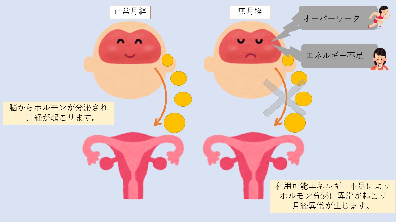 視床下部性無月経とは？ その1
