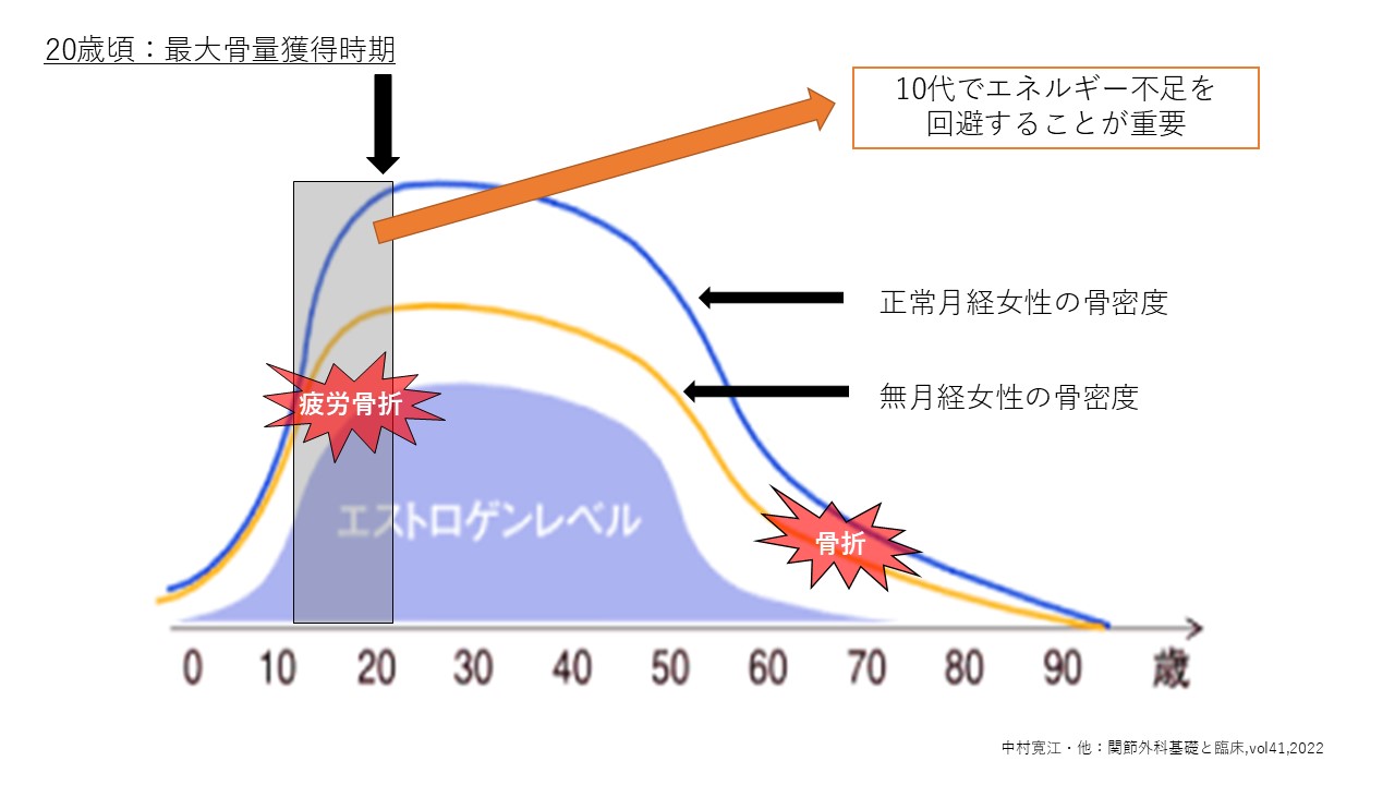 骨粗鬆症とは？